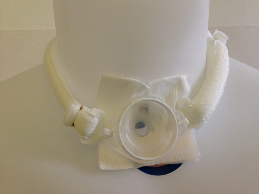 Nurse The care of laryngectomised patient Laryngectomy